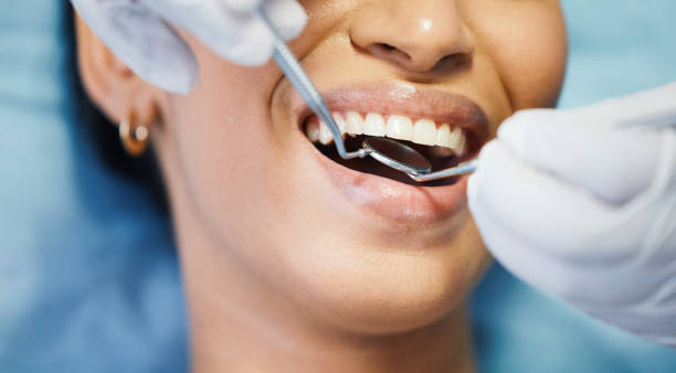 Best Broken or Chipped Tooth Repair in Wailua Homesteads, HI